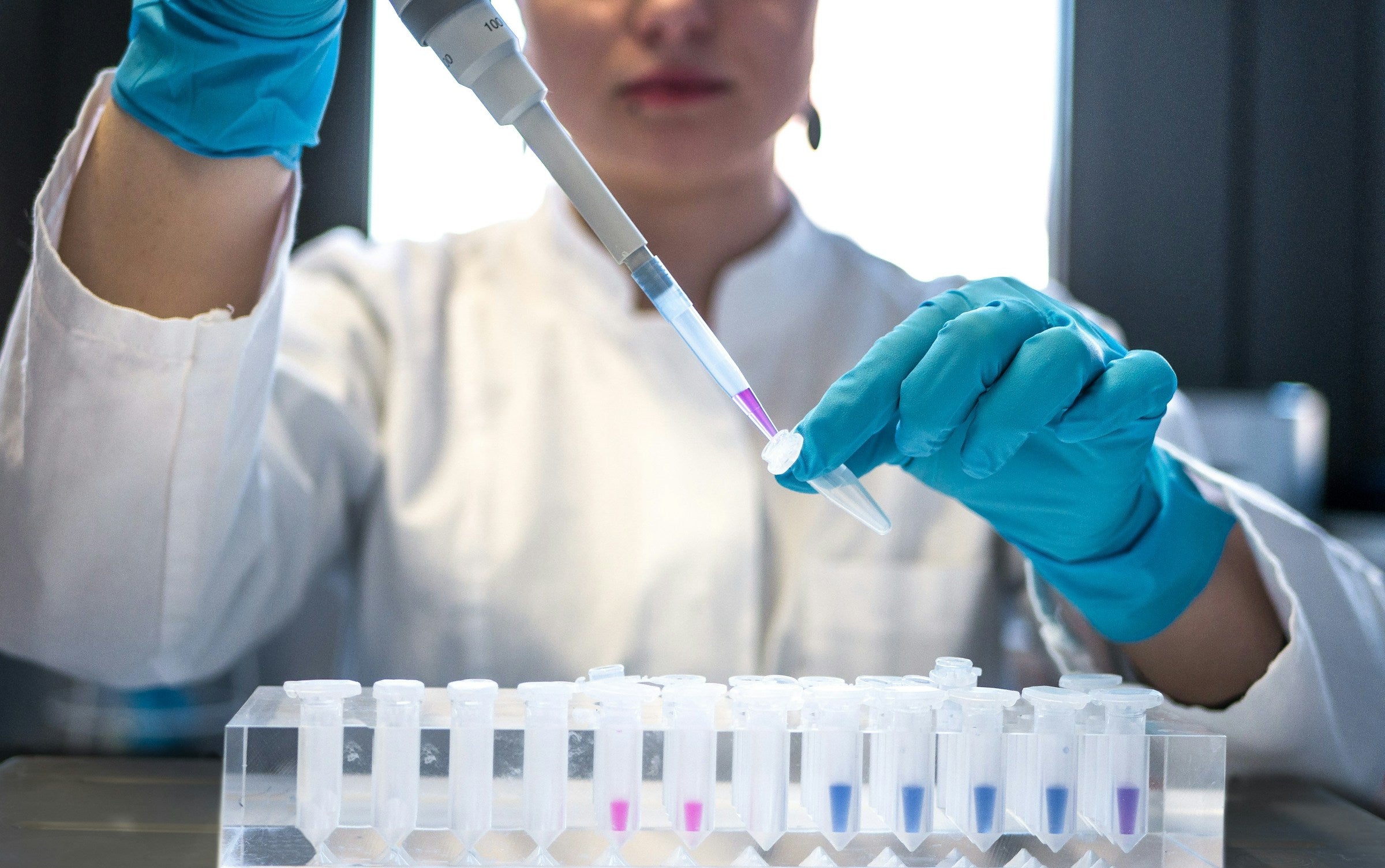 Ketohexokinase: Pharma Wants to Block It. Luteolin Already Does in the Lab.